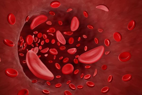 sickle cells passing through a blood vessel