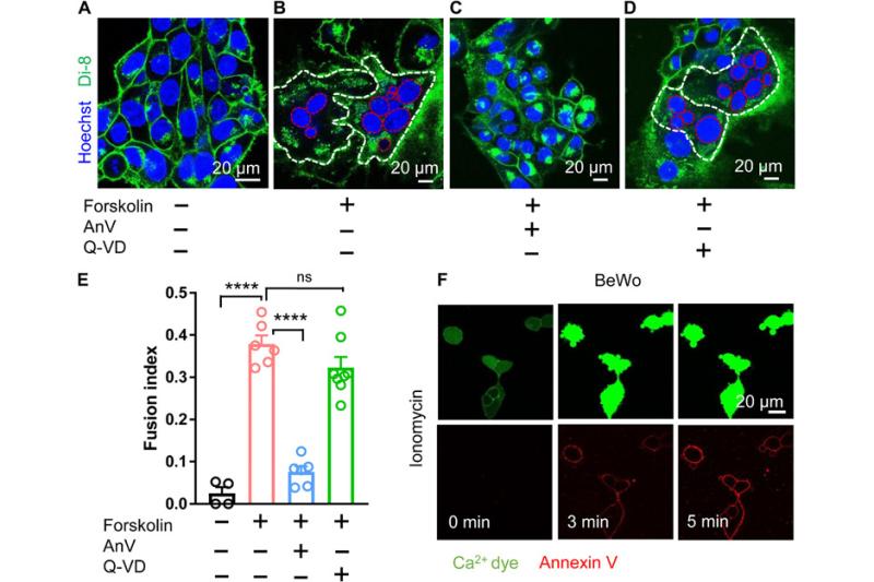 TMEM16F CaPLSase in trophoblast fusion and placental development