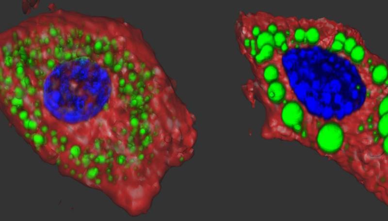 Fat cells with the R1788W ankyrin-B mutation (shown on the right) have enlarged lipid droplets. The green color highlights the sites of fat storage in mouse adipose cells. Nuclei are shown in blue.
