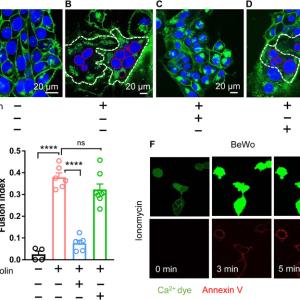 TMEM16F CaPLSase in trophoblast fusion and placental development