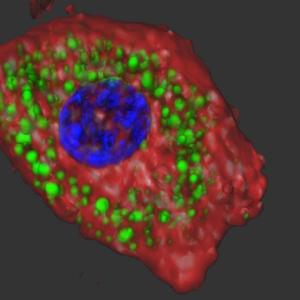 Fat cells with the R1788W ankyrin-B mutation (shown on the right) have enlarged lipid droplets. The green color highlights the sites of fat storage in mouse adipose cells. Nuclei are shown in blue.